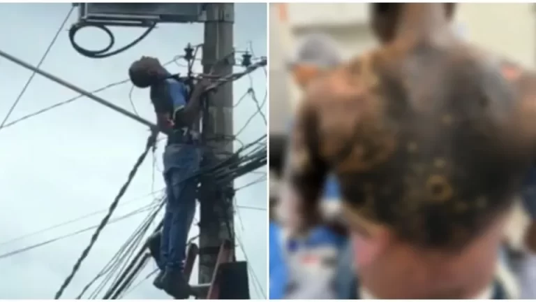 Eletricista leva grave choque e roupa pega fogo em poste